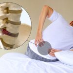 лечение грыжи позвоночника без операции в Алматы