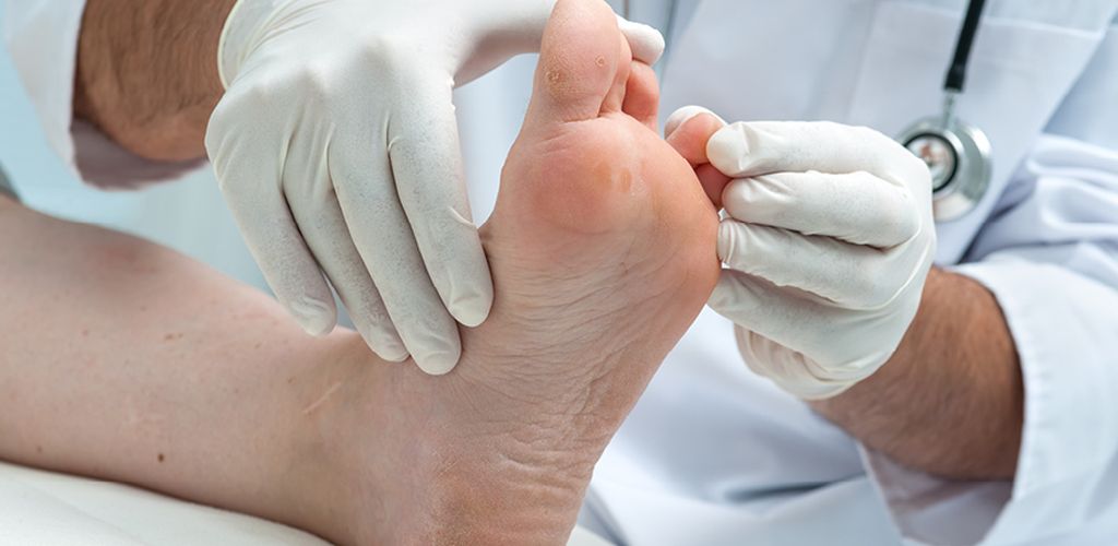 Лечение диабетической стопы в Алматы